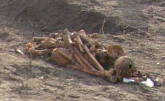 Bones